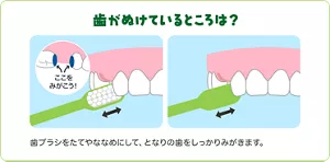 歯がぬけているところは?:歯ブラシをたてやななめにして、となりの歯をしっかりみがきます。
