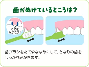 歯がぬけているところは?:歯ブラシをたてやななめにして、となりの歯をしっかりみがきます。