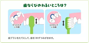 歯ならびのわるいところは?:歯ブラシをたてにして、歯を1本ずつみがきます。