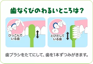 歯ならびのわるいところは?:歯ブラシをたてにして、歯を1本ずつみがきます。