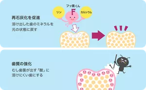 再石灰化を促進:溶け出した歯のミネラルを元の状態に戻す/歯質の強化:むし歯菌が出す「酸」に溶けにくい歯にする