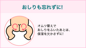 おしりも忘れずに! オムツ替えで おしりをふいたあとは、 保湿を欠かさずに!