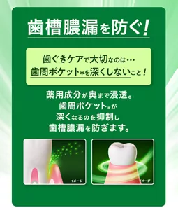 歯槽膿漏を防ぐ! 歯ぐきケアで大切なのは・・・歯周ポケット(*)を深くしないこと! 薬用成分が奥まで浸透。歯周ポケット(*)が深くなるのを抑制し歯槽膿漏を防ぎます。