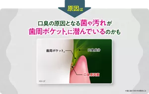 原因は、口臭の原因となる菌や汚れが歯周ポケット(*)に潜んでいるからかも(*歯と歯ぐきのすき間のこと)
