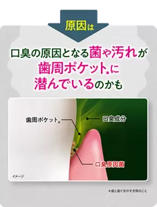 原因は、口臭の原因となる菌や汚れが歯周ポケット(*)に潜んでいるからかも(*歯と歯ぐきのすき間のこと)