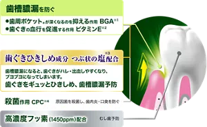 歯槽膿漏を防ぐ。歯周ポケット(*)が深くなるのを抑える作用 BGA(※1)。歯ぐきの血行を促進する作用 ビタミンE(※2)。歯周ポケットが深くなると、次第に歯槽膿漏になり、歯を支える骨まで溶けてしまいます。(*歯周ポケット:歯と歯ぐきのすき間。)/歯ぐきひきしめ成分 つぶ状の塩(※3)配合。歯槽膿漏になると、歯ぐきがハレ・出血しやすくなり、ブヨブヨになってしまいます。歯ぐきをギュッとひきしめ、歯槽膿漏予防。/殺菌作用 CPC(※4)。原因菌を殺菌し、歯肉炎・口臭を防ぐ。/高濃度フッ素(1450ppm)配合。むし歯予防