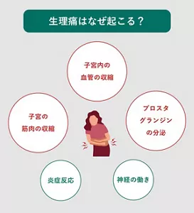 「生理痛はなぜ起こる?」の説明画像。おもな要因:・子宮内の血管の収縮・プロスタグランジンの分泌・神経の働き・炎症反応・子宮の筋肉の収縮