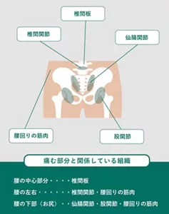 「痛みが出やすい腰の場所と要因」の説明画像。痛みが出やすい部分:椎間板・仙腸関節・股関節・腰回りの筋肉・椎間関節 / 痛む部分と関係している組織:・腰の中心部分→椎間板・腰の左右→椎間関節、腰回りの筋肉・腰の下部(お尻)→仙腸関節、股関節、腰回りの筋肉
