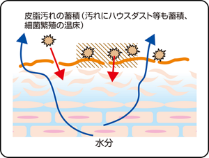 皮膚バリア機能が低下した状態のイラスト図