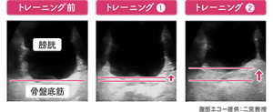 トレーニング前、トレーニング①、トレーニング②の腹部エコ―写真。二宮教授提供。