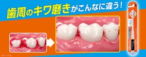 歯周のキワ(*)磨きがこんなに違う!(*歯とハグキの境目)