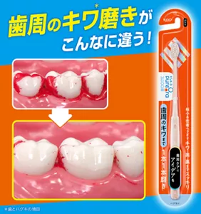 歯周のキワ(*)磨きがこんなに違う!(*歯とハグキの境目)