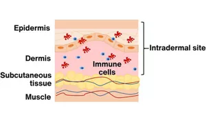 A figure showing that immune cells are abundant in the intradermal site.