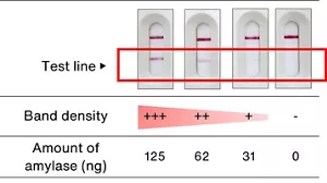 Results of detecting amounts of amylase by immunochromatography. The results were judged based on the band densities of the test lines relative to the reference density. Band density of three-plus is equivalent to 125 ng of amylase, two-plus density to 62 ng, one-plus density to 31 ng, and the one-minus density to 0 ng.