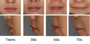 Figure: Photographs of typical lips of women in their teens, 30s, 50s and 70s. A photo taken from the front and another taken from the side is arranged for each age group, showing that the vertical width of the lips decreases with age and the lateral width increases with age. With age, the lower lip looks less full when viewed from the side. The length between the upper lip and the nose becomes longer.