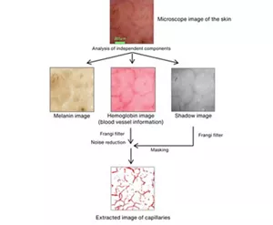The image illustrates the algorithm for generating a capillary extraction image. A microscope image of the skin is separated using individual component analysis into a melanin image, a hemoglobin image, and a shadow image. Filters are then applied to extract an image of the capillaries.