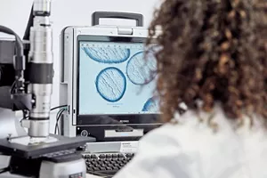 A researcher observing a microscopic image of a cross-section of hair