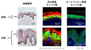 肘部と腕部における皮膚組織、角化、オートファジーに関連するタンパク質の分布を比較
