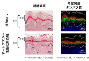 器官培養した角層肥厚を伴う肘部の皮膚組織でのオートファジー活性化による角化の変化を観察