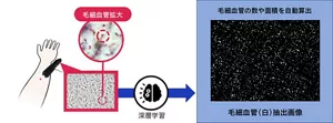 1000本以上の毛細血管を一度に可視化し定量化する技術の説明イメージ図