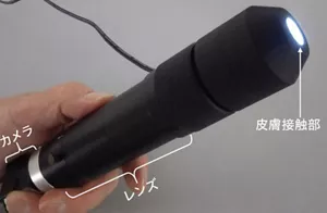 図1。広い視野で膨大な数の毛細血管を観察できる、新規開発したデバイスの外観写真