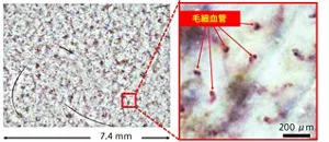 図2 開発したデバイスで撮影した皮膚毛細血管画像の例。右は拡大図。