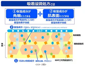 吸着浸潤処方の模式図