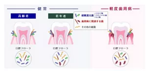 健常高齢者、健常若年者、軽度歯周病の口腔フローラのイメージ図
