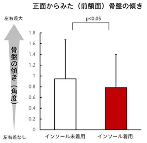 インソール着用で骨盤の傾きが補整されたことを示す図