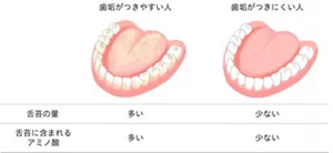 歯垢がつきやすい人と歯垢がつきにくい人の違い