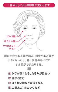 「骨やせ」により顔印象が変わります 顔の土台である骨が縮み、頬骨やあご骨が 小さくなったり、骨と皮膚のあいだに すき間ができたりする。 シワが深くなる、たるみが目立つ 目がくぼむ ほうれい線などが深くなる 二重あご、首のシワなど