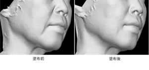 モデル処方の塗布前と塗布後の3D画像の比較。塗布前は、ほうれい線が目立ち、塗布後はほうれい線が目立ち難い。