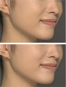 肌色を微妙に調整した顔写真の比較。