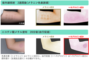 肌への紫外線照射によってメラニン量を、ニコチン酸メチル塗布により血行を人為的にコントロールできる。この実験から色素沈着はメラニン成分、血行促進はヘモグロビン成分によるものと分離できた。