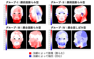 加齢変化の4つのパターン。顔の前側の膨らみ、側面の膨らみ、全体的な膨らみ、全体のしぼみ。
