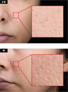 正面(左)および斜め前方(右)  の、異なる角度から見たメイク後の肌の半顔および毛穴の拡大画像