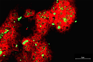 蛍光染色したヒトの皮脂の写真