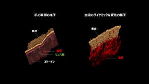 肌の裏の様子 表皮、血管、リンパ管、コラーゲン 血流のダイナミックな変化の様子 表皮、血流