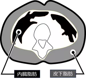 図1 X線CTによる腹部イメージ図。 体の臍位でのX線CT画像のイメージ図。腹部の内臓周りについている内臓脂肪と、皮下についている皮下脂肪があることを示す。