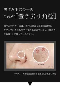 黒ずみ毛穴の一因これが「置き去り角栓」黒ずみ毛穴の一因は、毛穴に詰まった層状の角栓。ケアしているつもりでも落としきれていない「置き去り角栓*」が残っていることも。*ソフィーナ美容液洗顔料では落としきれない角栓