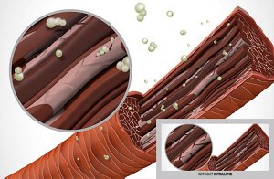 ds rich repair technology intralipid