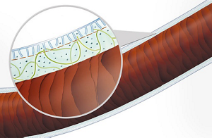 medium teaser technologie st s