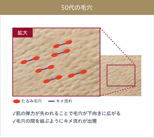 50代の毛穴の拡大画像。 肌の弾力が失われることで毛穴が下向きに広がる 毛穴の間を結ぶようにキメ流れが出現