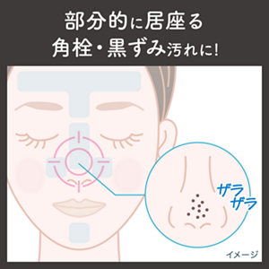 部分的に居座る角栓・黒ずみ汚れに！　ザラザラ　イメージ