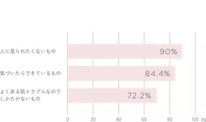 ニキビは、どんな存在？90%人に見られたくないもの　84.4%気づいたらできているもの　72.2%よくある肌トラブルなのでしかたがないもの