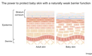 The power to protect baby skin with a naturally weak barrier function