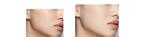 Before After