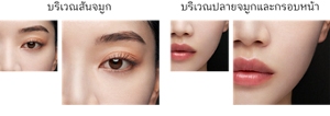 บริเวณสันจมูก บริเวณปลายจมูกและกรอบหน้า Before After