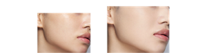 Before After