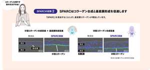 SPARCの役割2：SPARCはコラーゲン合成と基底形成を促進します